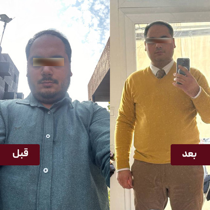 improve style